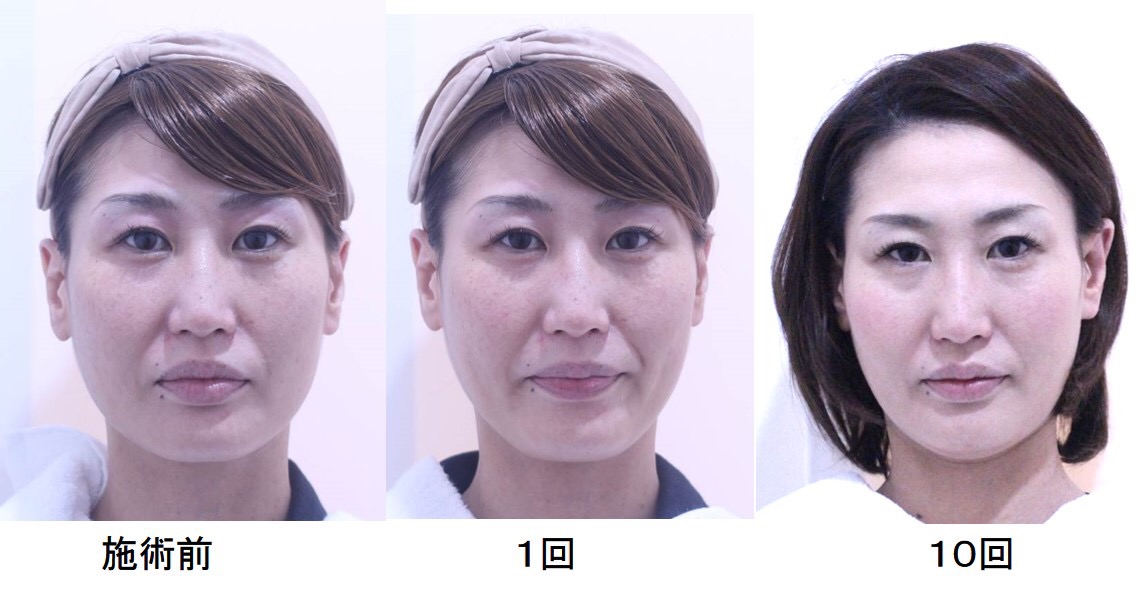 小顔coul 福生の美容室 Flamingo